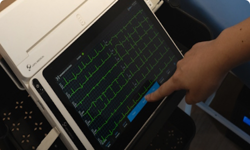 Electrocardiogram (ECG)